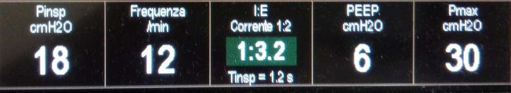 Ciclaggio a tempo Controllo Quando il paziente non compie atti respiratori volontari è possibile