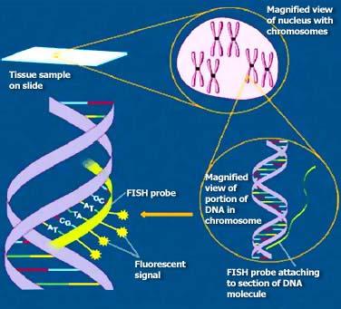 visualizzazione della posizione di un gene.