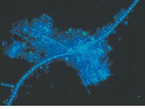 Le cellule rappresentate in figura sono state colorate con DAPI e visualizzate al microscopio a fluorescenza. Cosa si può dire con buona sicurezza di queste cellule? A. Sono tutte vive B.
