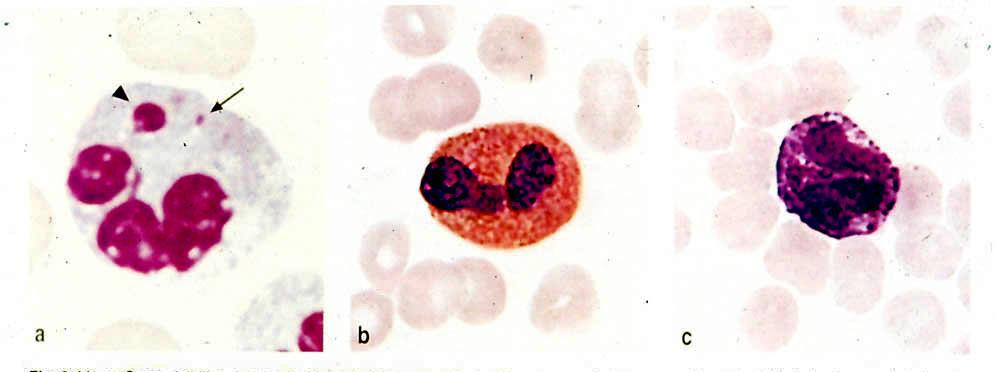 granulociti Striscio di sangue periferico umano femminile. a. granulocito neutrofilo con granuli specifici citoplasmatici più numerosi e piccoli (al limite della visibilità al M.O.