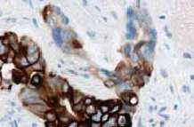 CITOCHERATINE CK20 CK 7 This antibody may be used to aid in the