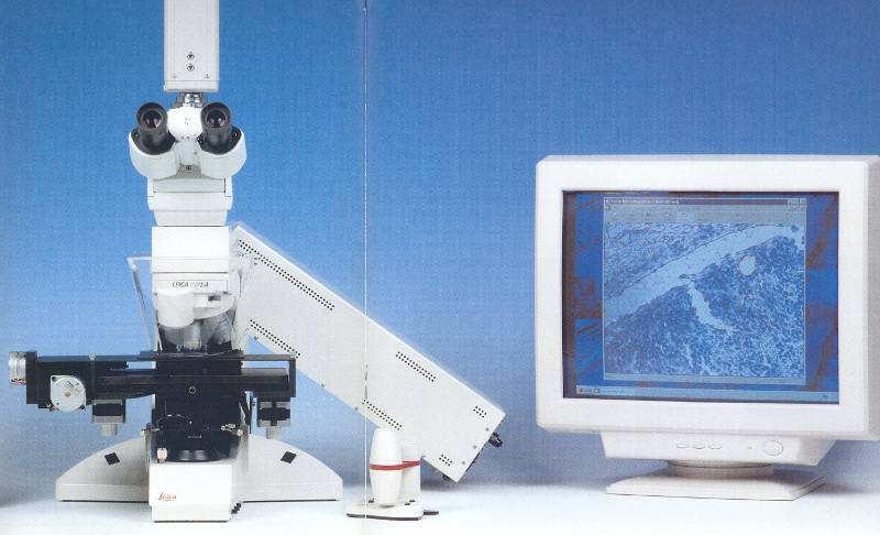 Microdissezione laser della sezione per l