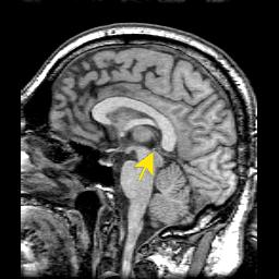 Fig. 19. Immagine sagittale di un cervello umano ottenuta con la risonanza magnetica. 3) LA SPETTROSCOPIA DI FOTOEMISSIONE 3.