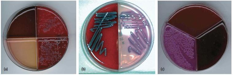 Figura 2.3.3.1. Alcune tra le principali tipologie di piastre impiegate nei protocolli di OFC (Risco e Melendez, 2011. Modificato).