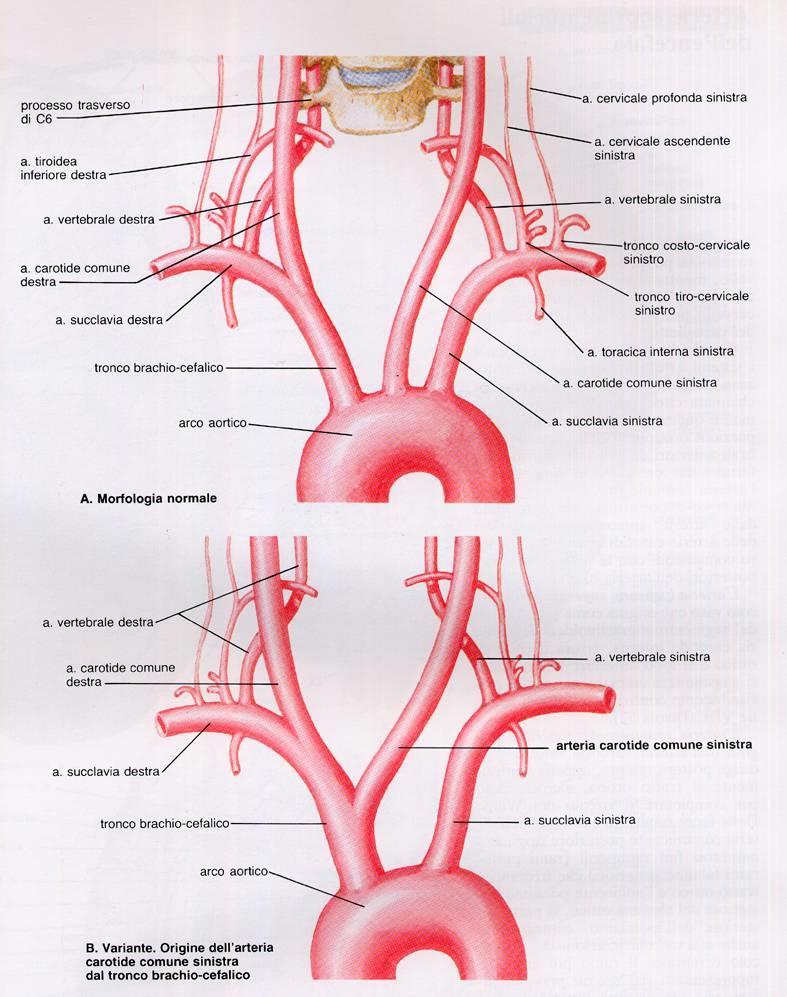 ARTERIE EXTRACRANICHE Arco dell Aorta fino all origine della Succlavia sinistra Tronco Brachiocefalico A.