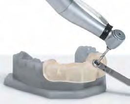 precise, Dental Model Resin è un materiale ad alte prestazioni per i modelli di corone e ponti con monconi sfilabili.