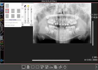 (LL), Carpo spazio necessario per Art Plus / XPan DG / X Pan Art Plus C / XPan DG Plus / XPan Ceph 1100 mm 865 mm Dalla colonna alla parete 740 mmm Altezza