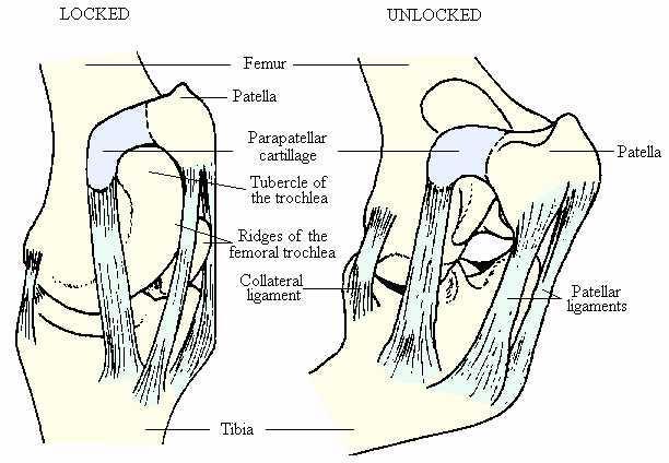 Per ridurre la fatica: meccanismo di fissaggio della rotula (con conseguente immobilizzazione del ginocchio).