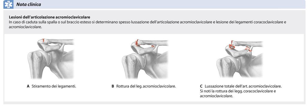 Lesioni e Lussazione dell articolazione Acromio-Clavicolare Danni traumatici a carico delle articolazioni