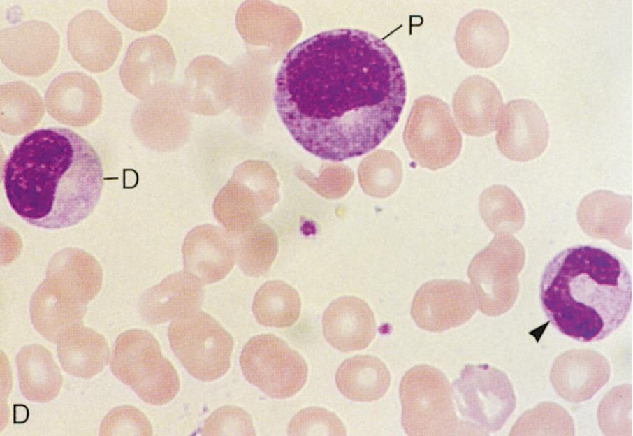 Promielocita Inizio eterocromatina e granulazioni azzurrofile Mielocita