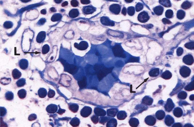 Paracorticale Venule post-capillari con endotelio più permeabile (Punto di uscita dei linfociti dal circolo
