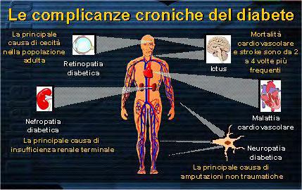 Figura 3 La Retinopatia Diabetica è la più frequente complicanza cronica del diabete ed il rischio aumenta in funzione della durata della malattia.