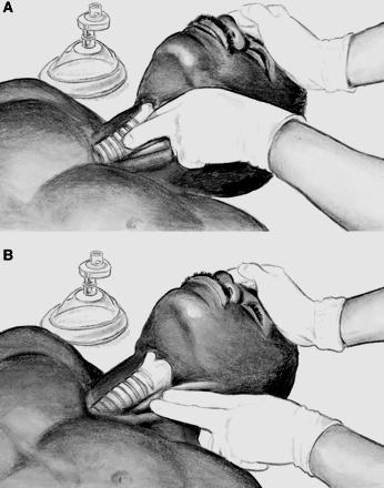 C: circulation (circolo) C: circulation (circolo) Frequenza cardiaca