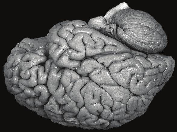 Un sistema di trasduzione trasforma a livello delle teminazioni nervose sensitive del nocicettore gli stimoli potenzialmente dannosi in treni di potenziali d azione.