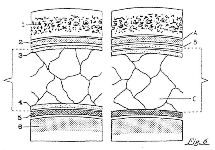 Figura 6- Disposizione delle meningi craniche (secondo Bourrer e Louis). A sinistra: concezione moderna. A destra: concezione classica (di Bichat). 1. Diploe 2. Dura madre 3.