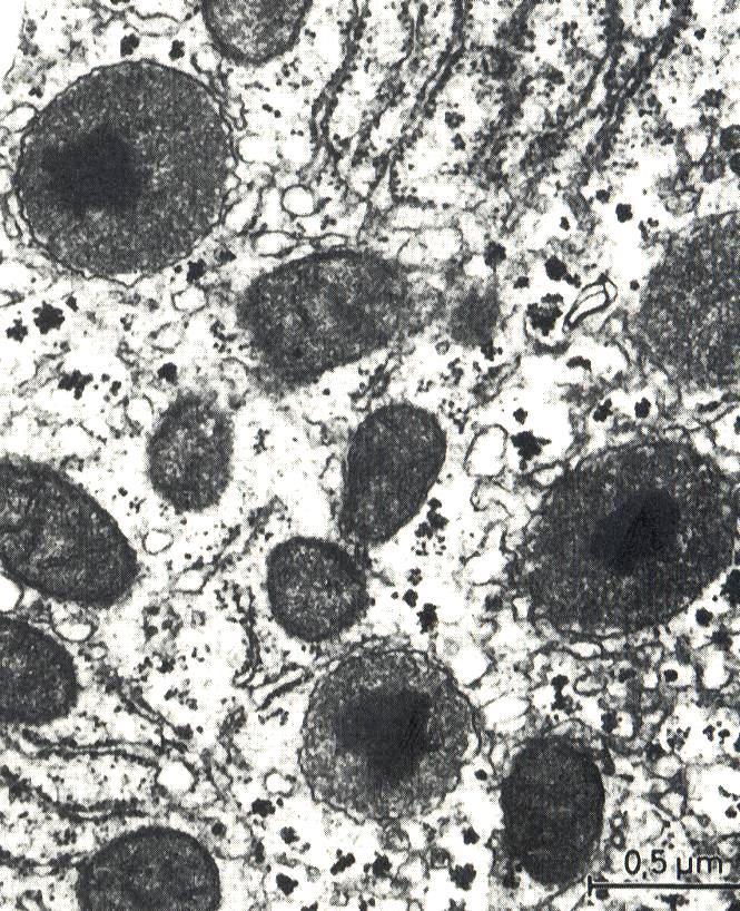 Perossisomi ( microcorpi ) vescicole circondate da una sola membrana con un nucleo denso formato da enzimi ossidativi matrice