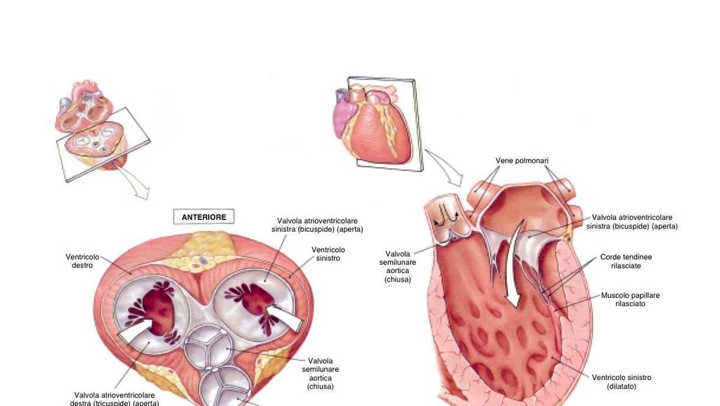 Gli atri che hanno pareti più sottili dei ventricoli, si dilatano via via che si riempiono di sangue,