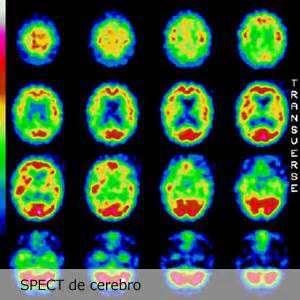 LE ATTIVITA DEL FISICO MEDICO Medicina nucleare La medicina nucleare è quella branca della medicina che utilizza sostanze radioattive (radiofarmaci) in diagnostica e in terapia.