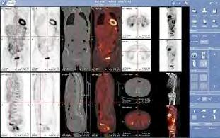 PACS Una parte fondamentale ma non visibile dall'utente finale si occupa del colloquio con gli altri attori del flusso radiologico, utilizzando di solito i relativi profili IHE (Integrating the