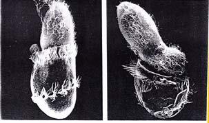 report=objectonly Phagocytosis by a neutrophil An electron micrograph of a neutrophil phagocytosing a