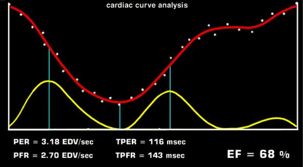 Analisi della curva Velocità di eiezione e riempimento EDV/sec Parametri poco usati se non in contesto sperimentale IMMAGINI PARAMETRICHE le