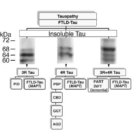 Parkinsonismi degenerativi Tauopatie