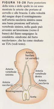 TEOREMA di BERNOULLI 9 h + p v = costante d g + g conseguenze aneurisma se si dilata tende ad allargarsi stenosi se si ostruisce tende a chiudersi TEOREMA di BERNOULLI conseguenze teorema di