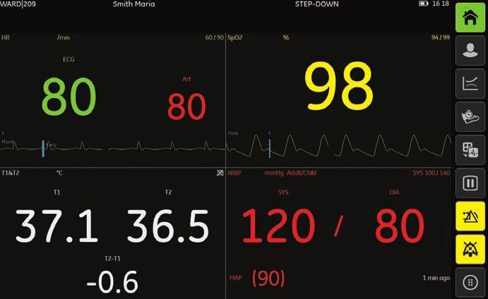 Prestazioni cliniche su cui potete contare Con alle spalle oltre 40 anni di innovazione nelle tecnologie di misurazione dei parametri, GE Healthcare è all avanguardia nella continua ricerca e