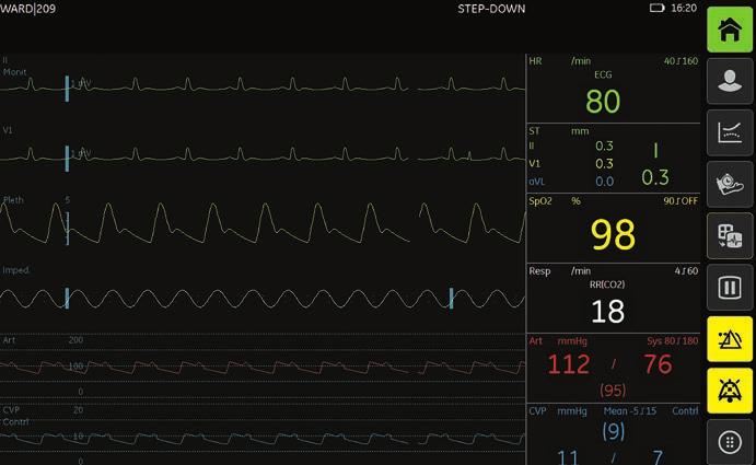 Il nostro ampio portfolio di monitoraggio punta su prodotti all avanguardia dotati di tecnologie avanzate quali: DINAMAP TM SuperSTAT TM NIBP Tecnologia NIPB di comprovata validità che utilizza il