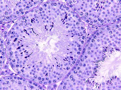 cells > 17b-estradiolo Cellule del Sertoli: