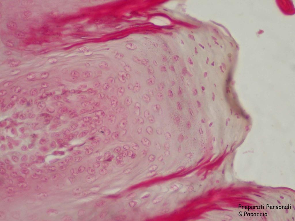 Epitelio pavimentoso pluristratificato non