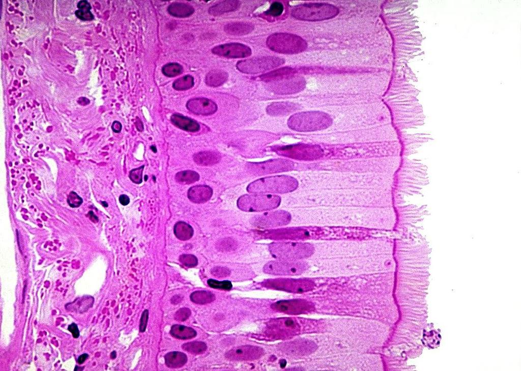 trachea: esempio di