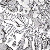 Ghisa Bianca Il carbonio è presente sotto forma di carburo di ferro Fe 3 C (cementite) Questa ghisa presenta una struttura argentea, fragile, durissima e per queste sue caratteristiche non risulta