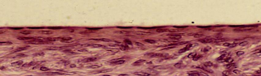 dell'ansa di HENLE) nelle membrane sierose