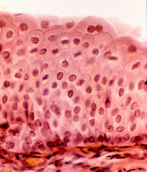 EPITELIO POLIMORFO o DI TRANSIZIONE Esso possiede la caratteristica di modificare il suo