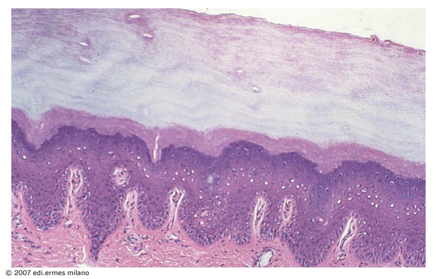 EPITELIO PAVIMENTOSO COMPOSTO SECCO L' epitelio pavimentoso composto secco o corneificato in corrispondenza della superficie libera presenta uno strato di cellule disidratate che costituiscono una