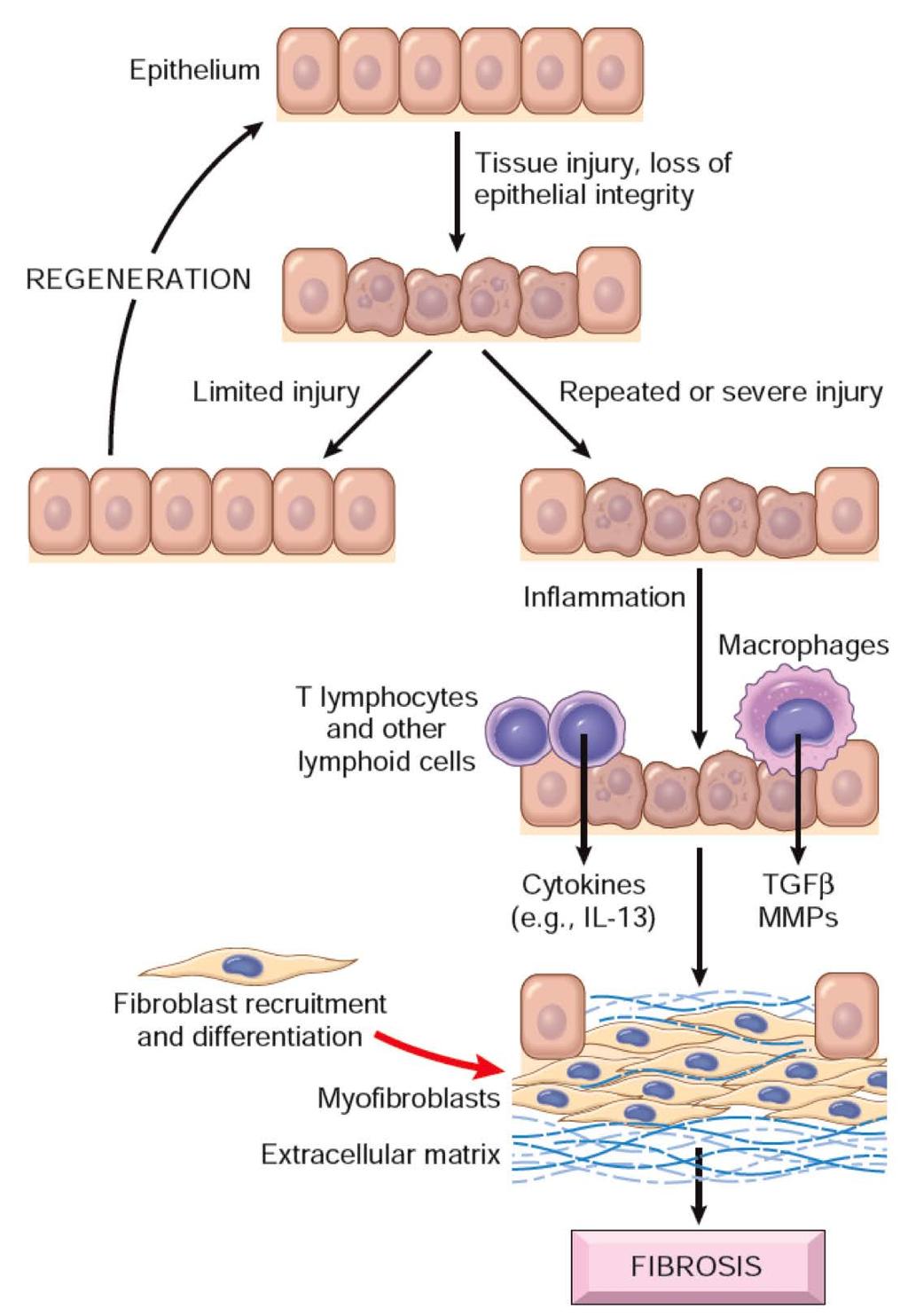 Cytokines produced by macrophages M2 and other leukocytes stimulate the migration and