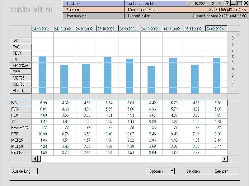 LUMED srl Confronto grafico tra le prove eseguite in diverse date:. sintesi grafica.