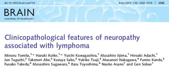 Neuropathy can occur at any stage of lymphoma Misdiagnosis of neurolymphomatosis as CIDP is frequent due to a presence of a demyelinating pattern and initial response to