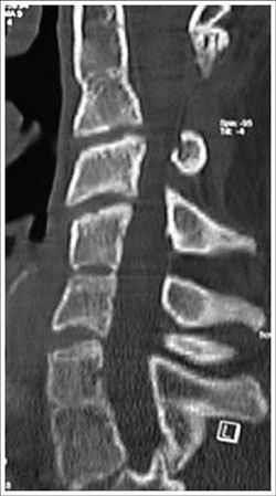 La Risonanza Magnetica infatti permette di studiare molto bene le strutture nervose, ligamentose ed articolari, mediante acquisizione dell immagine nei tre piani dello