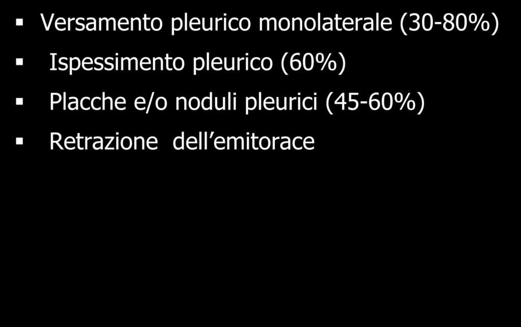 Mesotelioma Pleurico Maligno Radiogramma del Torace Versamento pleurico monolaterale