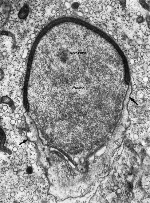 3. Fase acrosomiale * Acrosoma, nucleo e flagello si modificano.