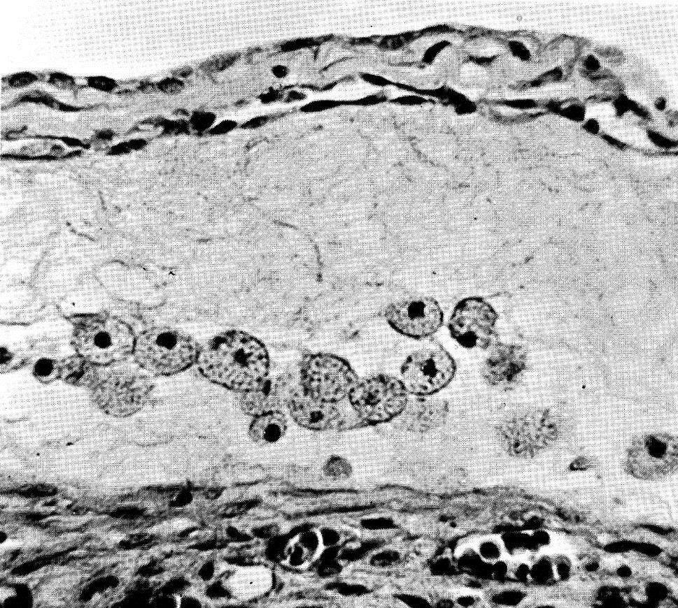 Cellule germinali primordiali (PGC). Embrione umano di 28 gg.