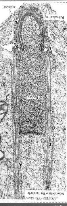 Acrosoma Perinuclear ring Nucleus