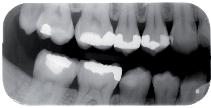 0: Imaging pediatrico Formato 1: Imaging periapicale Formato 2: