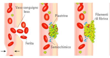 L EMOSTASI è quindi il complesso meccanismo tramite il quale l organismo porta all arresto di un processo emorragico, ossia un danno vascolare a cui fa seguito la