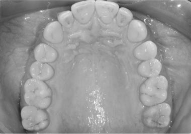 IL CORSO FOTOGRAFIA DIGITALE IN ODONTOIATRIA PRESENTAZIONE DEL CORSO 12 posti 06-07 luglio 2018 07-08 settembre 2018 La documentazione medica ha raggiunto dei traguardi notevoli.