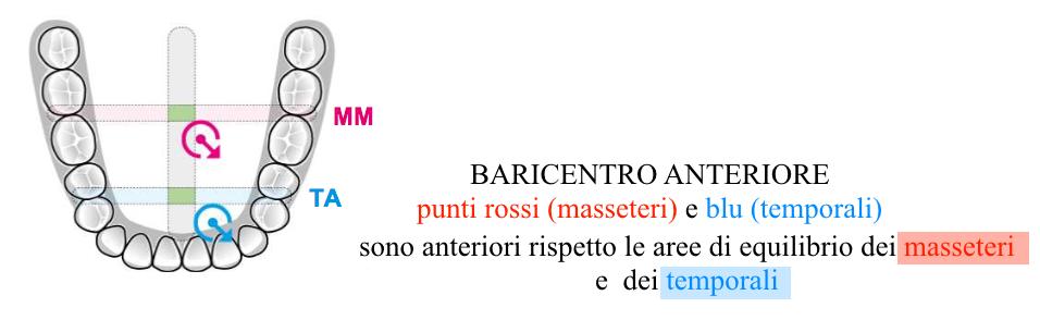 L obbiettivo nel posizionamento del sensore è quello di ottenere una registrazione chiara e il più stabile possibile.