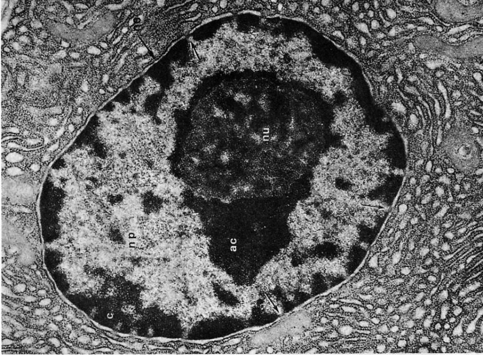 Il materiale genetico subisce una Transizione da fibrillare a