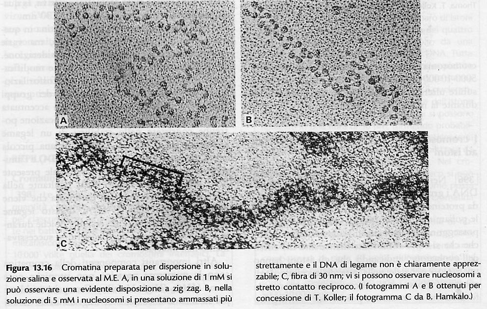 Aspetto della Cromatina a collana di